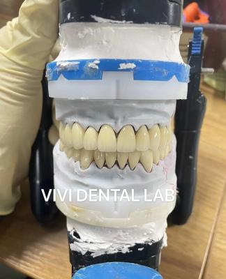 China Digital CAD CAM Dental Lab Crowns Translucent Layered Zirconia Crown for sale