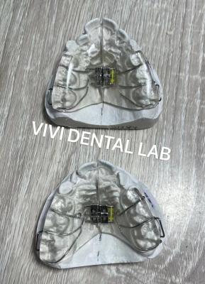 China Screw Arch Dental Teeth Palate Expander Removable Ortho Type for sale