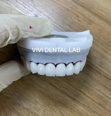 China Super White Zirconia Dental Lab Crowns 3D PRO PFZ Noritake Porcelain for sale