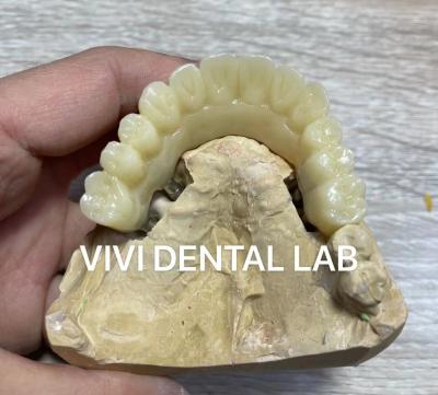 China Implant Temporary Crown And Bridge Dental PMMA Vita Shade for sale