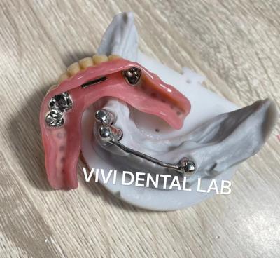 China Dentes de dentadura de acrílico completo con adjuntos en venta