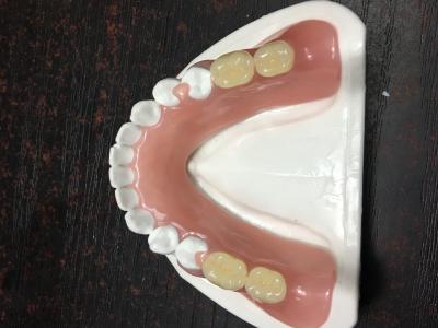 中国 完全歯科 柔軟性 透明性 部分歯科 販売のため