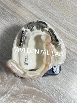 Chine Titane plein pont de zirconium translucide dentaire sur la barre d'implant à vendre