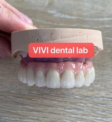 China Implantação estética de ponte dental com suporte a níquel sem berilio à venda