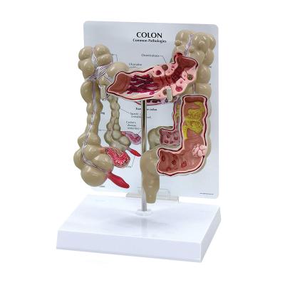 China Modelo de ensino humano For School da anatomia do grande intestino dos subministros médicos avançados e hospital à venda