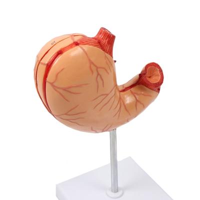 中国 良質の解剖学の人間の臓器の胃の病気にかかった解剖の胃教授モデル 販売のため
