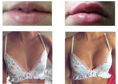 China Implant van de de Injectievuller van de borstuitbreiding Hyaluronic Zure Huidvuller van Lippeninjecties Te koop