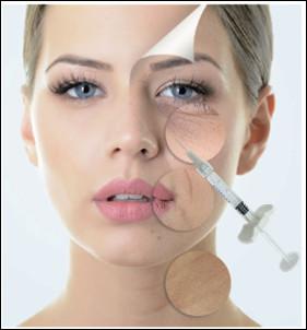Китай крест 1ml 1.1ml соединил Hyaluronic кисловочные дермальные заполнители для увеличения щеки Midface носа продается