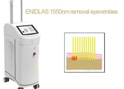 China Vidrio 1550 nanómetro del erbio del laser de la máquina del retiro de las marcas de estiramiento del CE en venta