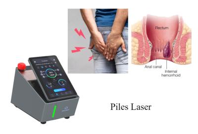China Two Wavelength Diode Laser Machine 980nm 1470nm Hemorrhoid Treatment for sale