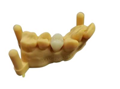 中国 適用範囲が広いアクリルの総義歯の歯科実験室のデジタル設計を印刷しているOEM 3D 販売のため