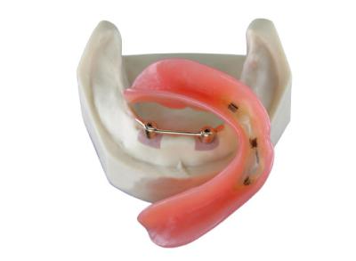 China High Biological Inter Miscibility Denture Dental Lab Safety Implant for sale