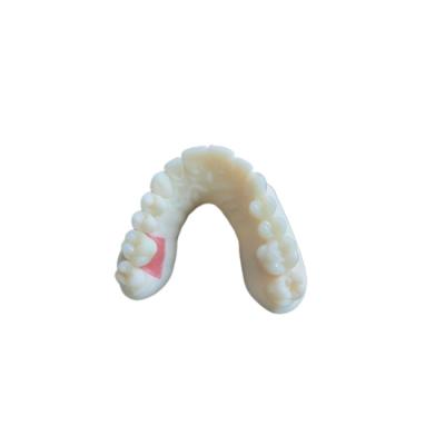 China Escaneo oral digital PFM Coronas dentales Puente Demandas de implantología en venta