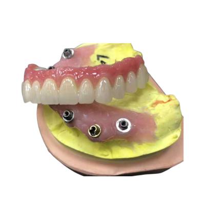 中国 4つの総義歯で完全に自然なインプラント迫台のジルコニアの歯科王冠 販売のため