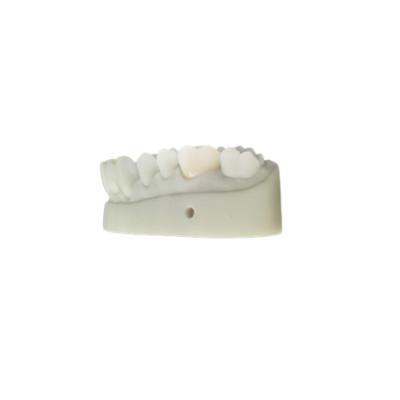 China OEM 3D Printed Dental Models CAD CAM Design For Denture Laboratory for sale