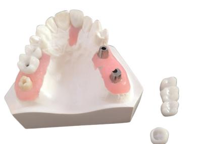 China FDA All Zirconia Crown with Implant-Supported Dentures for Dental Lab for sale