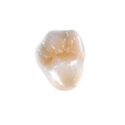 China Chapee ultra difícilmente las dentaduras de pulido del implante de la corona totalmente de cerámica dentales en venta