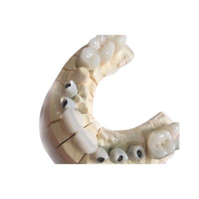 China Coronas dentales Biocompatibility excelente de la circona blanca libre del metal en venta