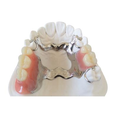 China OEM 3D Printer PFM Dental Crowns Bridge High Biological Intermiscibility for sale