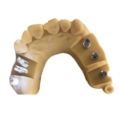 China Digital Biocompatibility PFM Dental Crown 3D Printing Temporary Crowns for sale