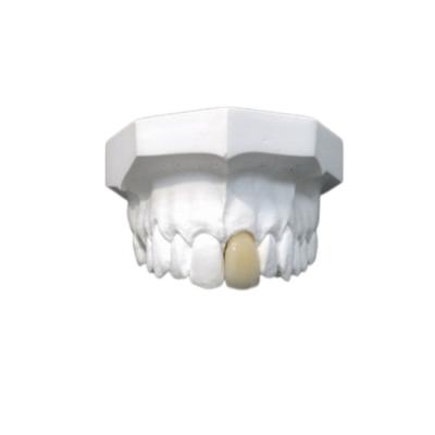 China Good Biocompatibility Porcelain Dental Crown High Tech Biological Material for sale