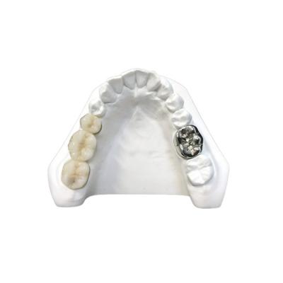 China Ultra Hard Digital Porcelain Dental Crown Health Safety High Density for sale