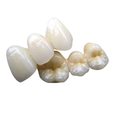 China PFM Co Cr 3014652903 Ceramic Dental Bridge Custom Colour Stability for sale