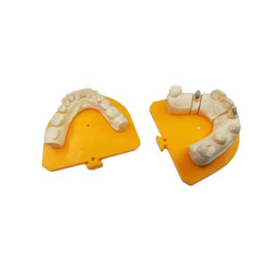 China High Strength Yellow Gold Porcelain Dental Crown PFM Ceramic Crown for sale