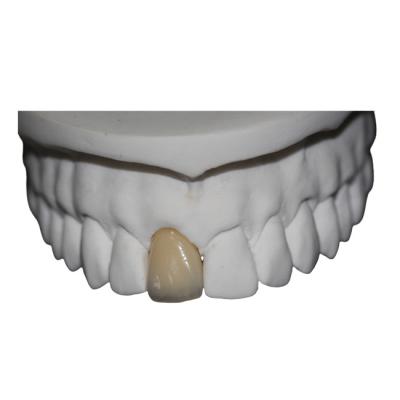 China Co Cr Porcelain Dental Crown for sale