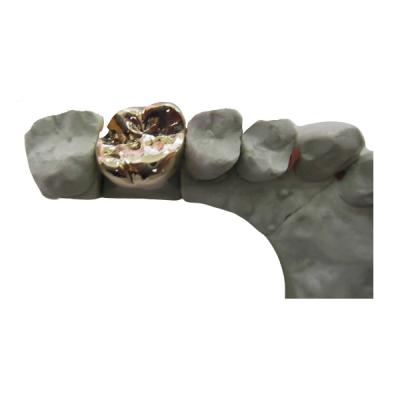 China Material biológico de High Tech del metal PFM del puente dental lleno de la corona en venta