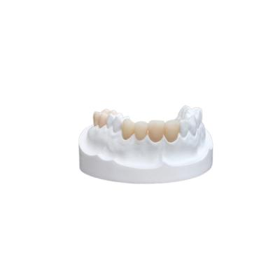China Chapa fuerte de la corona dental de cerámica de los sobrepuestos de los embutidos para el departamento dental en venta