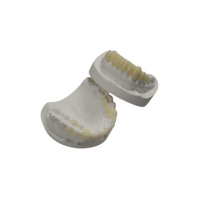 中国 注文TEMPの磁器の歯の王冠の象眼細工の上張りの強い硬度のベニヤ 販売のため