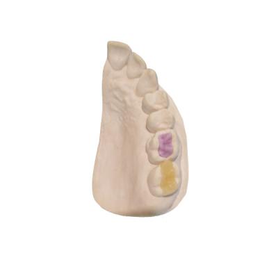 China Coroa Todo-cerâmica de FDA da cerâmica dental feita sob encomenda feita sob encomenda do alto densidade à venda