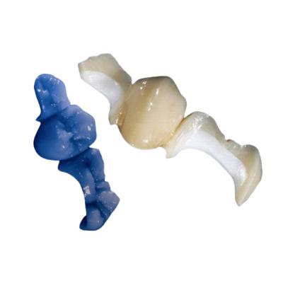 China OEM modificado para requisitos particulares que pule el sobrepuesto dental totalmente de cerámica del embutido de la chapa de la corona en venta