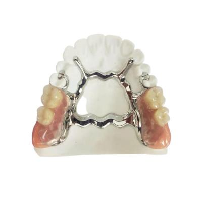 China Natrural Shade 3D Printing Fixed Removable Denture For Dentist Study for sale