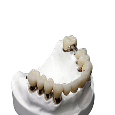 Chine Résistance à la corrosion de dentier d'attachement de précision du CR MK1 de Co à vendre