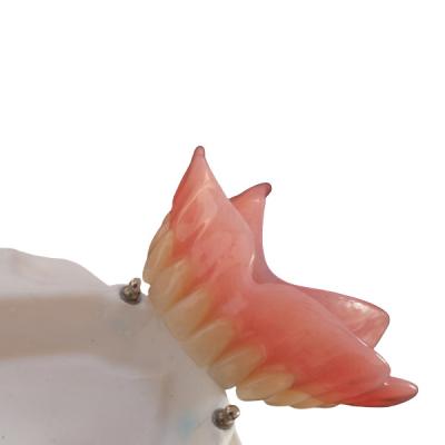 Chine Haut implant du dentier CAD-CAM d'attachement de précision de Biocompatibility à vendre