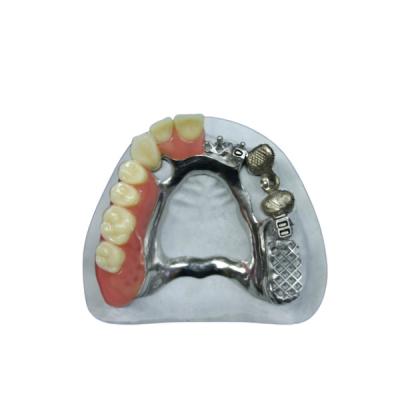 China Beautiful Appearance Precision Attachment Denture Implant Attachments for sale