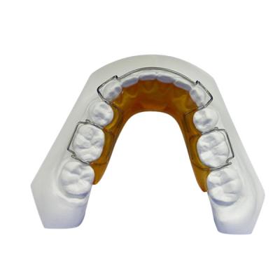 Κίνα Orthodontic συσκευές cOem για τα οδοντικά εργαστήρια εύκολα να εγκαταστήσουν την ισχυρή σταθερότητα προς πώληση