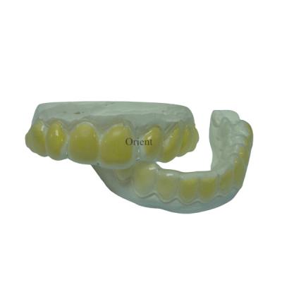 Κίνα Οι Orthodontic συσκευές FDA είναι αντιδιαβρωτικές και ανθεκτικές προς πώληση