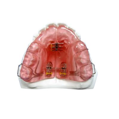 China Custom Removable OEM Fixed Orthodontic Appliance Good Durability for sale