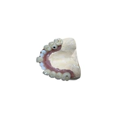 중국 정확한 생물학적 적합성 치과용 임플란트 부착 치아 임플랜트 크라운 판매용