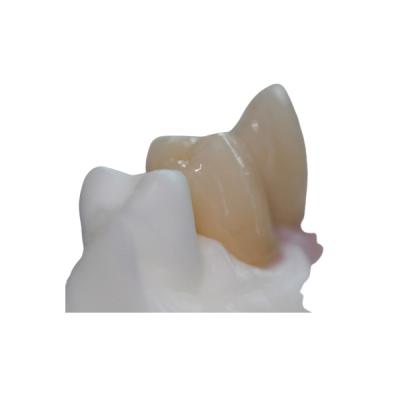 China Removable Pure Titanium Dental Implant Bar Custom Abutment for sale