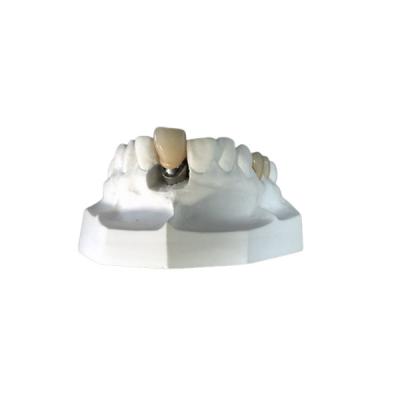 China Custom Dental Implant Locators High Stability Bar Attachment Denture for sale