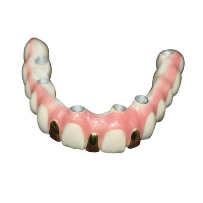 China Precision Digital 3D Printing Dental Implant Bar Metal Based for sale