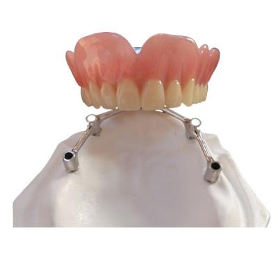 Chine Implants dentaires de FDA de couronne d'implant de dent de COCR avec la barre titanique à vendre