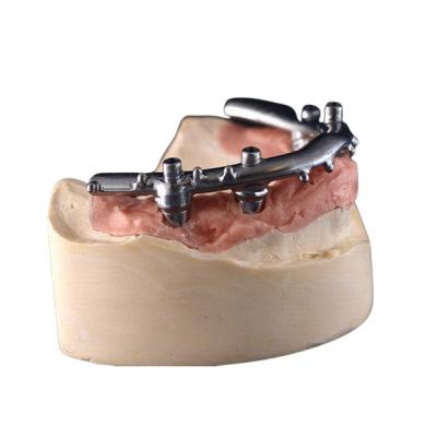 China High-Density PFM Dental Implants Dentures Strong Hardness Long Lasting​ for sale