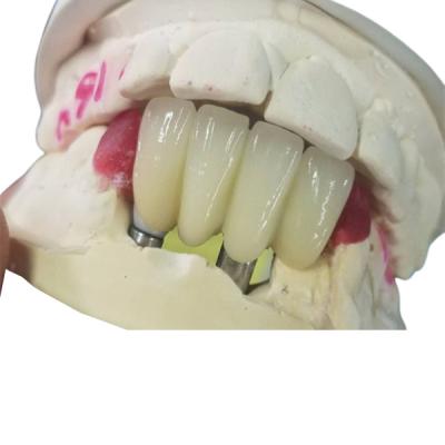 China Base fuerte del Ti que muele el puente apoyado diente de las coronas del implante dental en venta