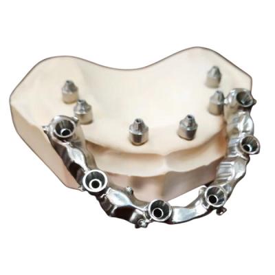 China FDA 3014652903 PFM bridge dental Highly Aesthetic Extremely Strong for sale