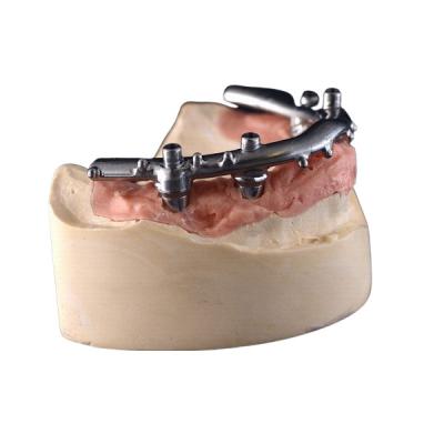 China All-On-4 Titanium CNC Implant Secured Dentures For Dental Clinic for sale